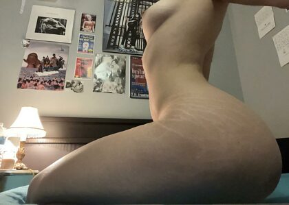 Do you like a girl with stretch marks ?