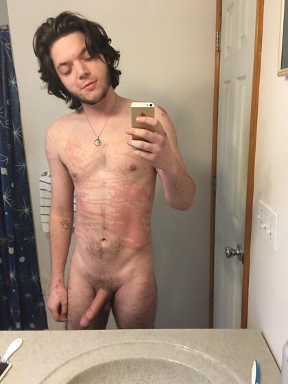 23 and super self conscious about my scars, I hope you guys and gals still find me attractive cause you’re all hot af