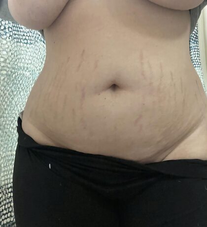 2024 is the year I stop being insecure about my stretch marks.