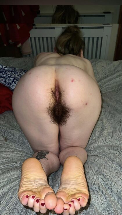 Should I feel embarrassed of my hairy ass?