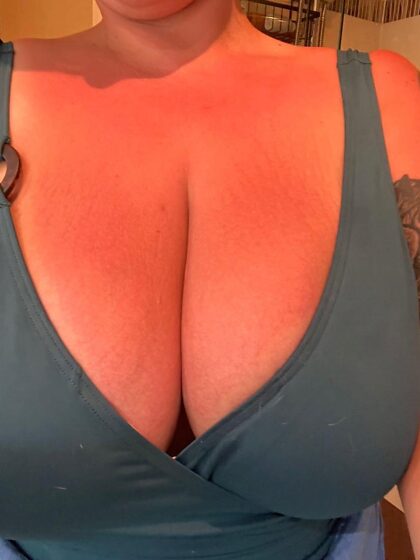 Big Burned Woman? My tits got a little too much sun
