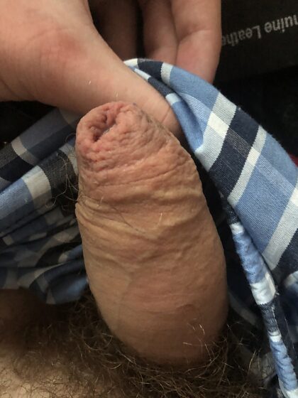 i hate my phimosis cock. but i think he deserve some love too. how would u rate it