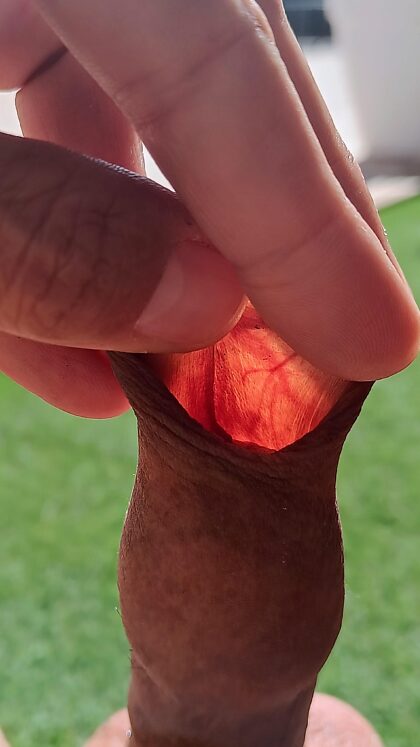 Have you ever seen your foreskin through the sun?