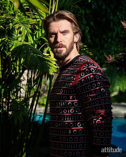 Dan Stevens est un véritable caméléon mais il est toujours magnifique