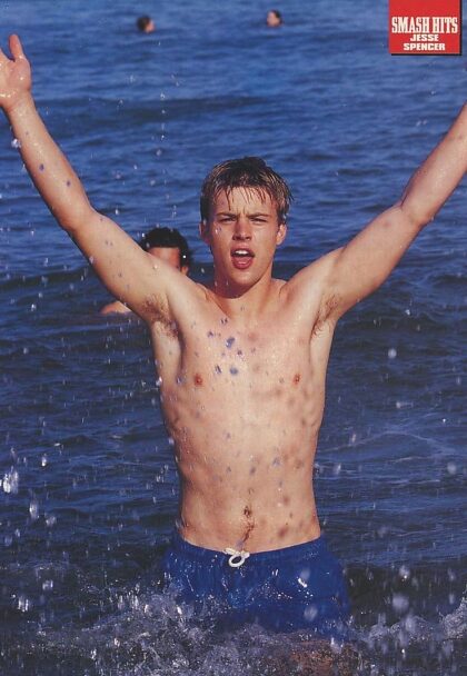 Un joven Jesse Spencer