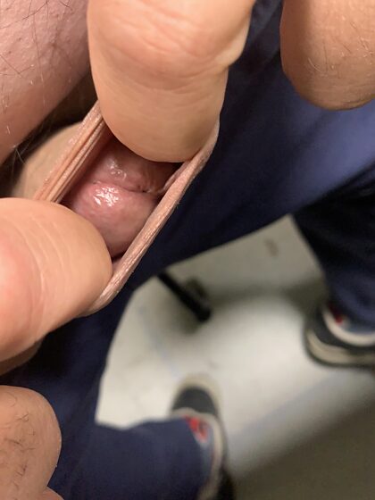 Anyone want to fuck my foreskin?