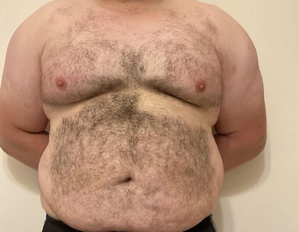 Barriga de urso.
